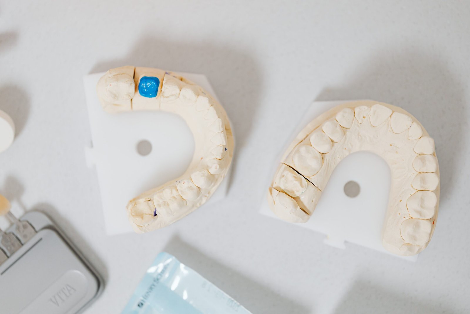 Close-up of dental teeth cast models on a table, used to prepare custom-fitted crowns